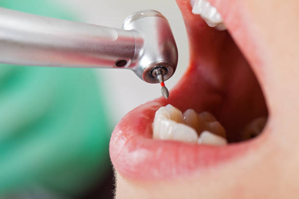 Best Weekend Emergency Dentist in Mason Neck, VA